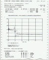 CMT2010 - typical print out - oscilloscope